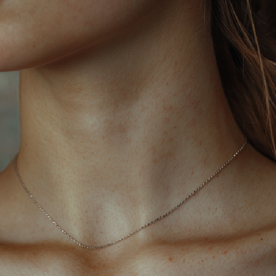 Nackenfalten: Warum sie passieren und wie man sie loswerden kann